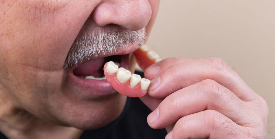 Fixierung von herausnehmbaren Zahnprothesen durch Mini-Implantate in Scheeßel